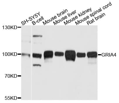 GRIA4 / GLUR4 Antibody