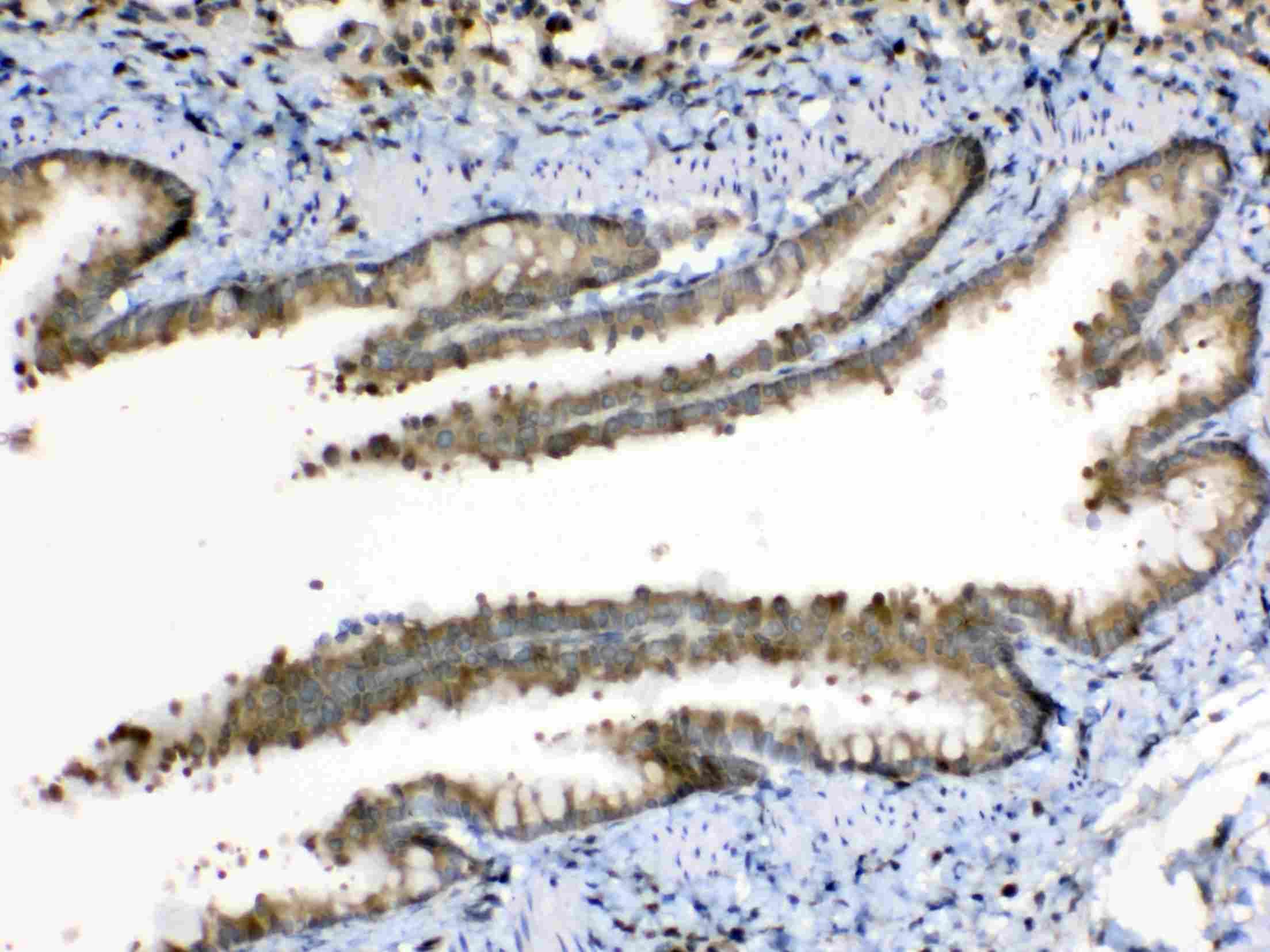 PPL / Periplakin Antibody