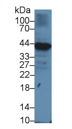 CD79A / CD79 Alpha Antibody (aa36-219, Cy3)
