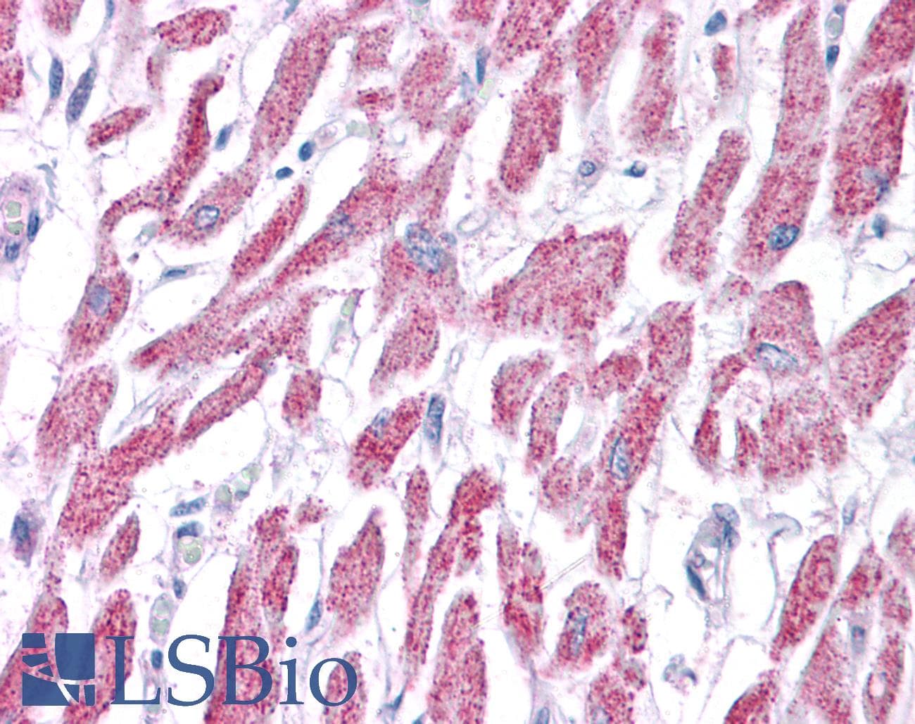 ACAT1 Antibody (aa218-267)