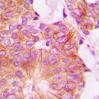 FHIT Antibody (Internal)