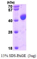 Human PDCD6IP / ALIX Protein (Recombinant His)
