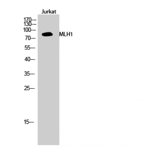 Polyclonal Rabbit anti-Human MLH1 Antibody (410-490 aa, Internal, IF, WB)