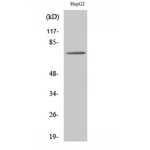 ABCD4 Antibody (80-160 aa, Internal)