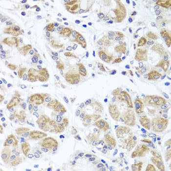 ACP1 / Acid Phosphatase Antibody