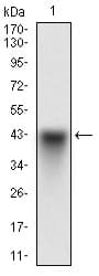 Monoclonal Mouse anti-Human SYCP3 / SCP3 Antibody (clone 6F9C5, aa27-128, IHC, IF, WB)