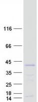 Human SMN2 Protein (Recombinant Myc-DDK (Flag))