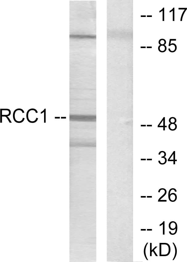 Polyclonal Rabbit anti-Human RARB / RAR Beta Antibody (aa331-380, IHC, WB)