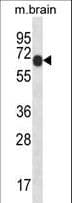 IHC-plus™ Polyclonal Rabbit anti-Mouse PXK Antibody (aa164-193, IHC, WB)