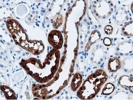 AK5 / Adenylate Kinase 5 Antibody (clone OTI2A2)