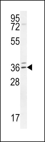 TPGS2 / C18orf10 Antibody (aa109-137)