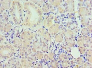 Polyclonal Rabbit anti-Human PAX6 Antibody (aa1-300, IHC)