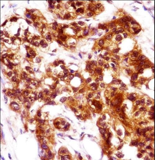 KRT7 / CK7 / Cytokeratin 7 Antibody (aa111-139)