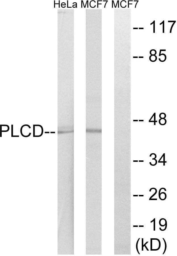 Polyclonal Rabbit anti-Human AGPAT4 Antibody (WB)