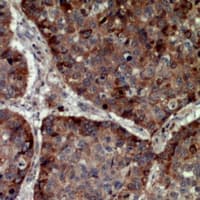 NTF3 / Neurotrophin 3 Antibody
