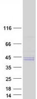 Human TPST2 Protein (Recombinant Myc-DDK (Flag))