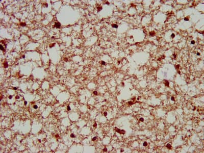 Polyclonal Rabbit anti-Human SERPINB12 Antibody