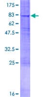 Human RTN4R Protein (Recombinant GST)