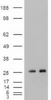 NOG / Noggin Antibody (clone OTI1C1)