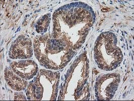 DSTN / Destrin Antibody (clone OTI1D5)