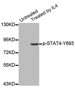 STAT4 Antibody (phospho-Tyr693)