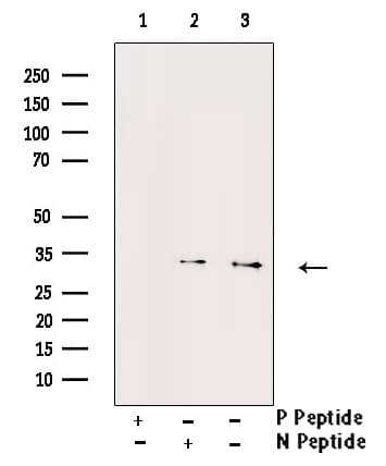 CCND1 / Cyclin D1 Antibody (phospho-Ser90)