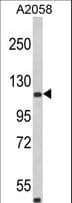 ARHGAP45 Antibody (aa877-903)