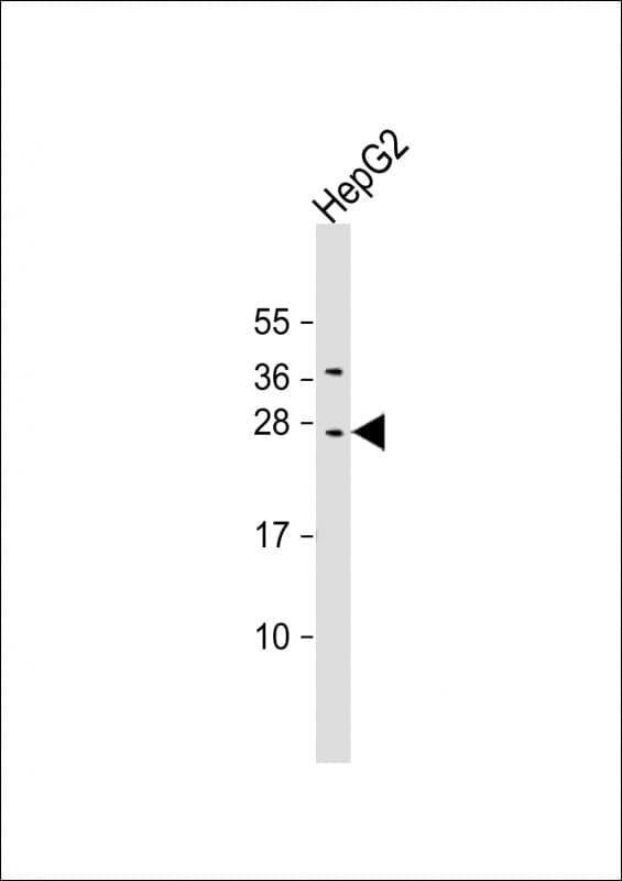 CIDEB Antibody (aa150-183)