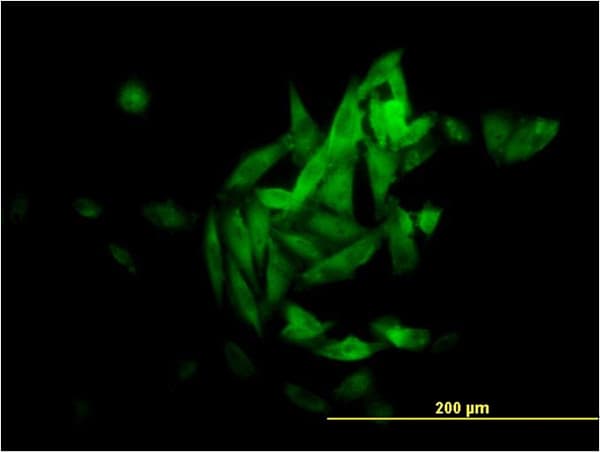 NQO1 Antibody (clone 1E3-A6)