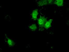 KHK / Ketohexokinase Antibody (clone OTI1F1)