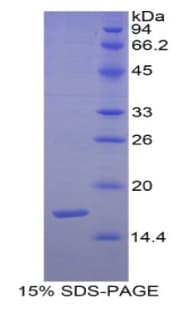 Human SEMA3F / Semaphorin 3F Protein (Recombinant His)