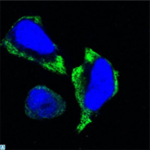 Monoclonal Mouse anti-Human PAK2 Antibody (IHC, IF, WB)