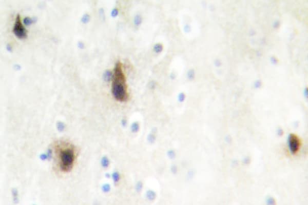 Polyclonal Rabbit anti-Human MVK Antibody (Asn175, IHC, IF, WB)