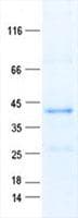 Human LRRC58 Protein (Recombinant His, N-Terminal)