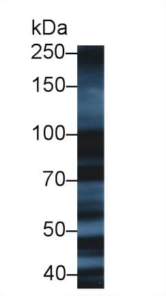 XRCC5 / Ku80 Antibody (aa2-460, APC)