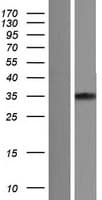 Human TNNT2 / CTNT Protein (Over-Expression Lysate Myc-DDK (Flag))