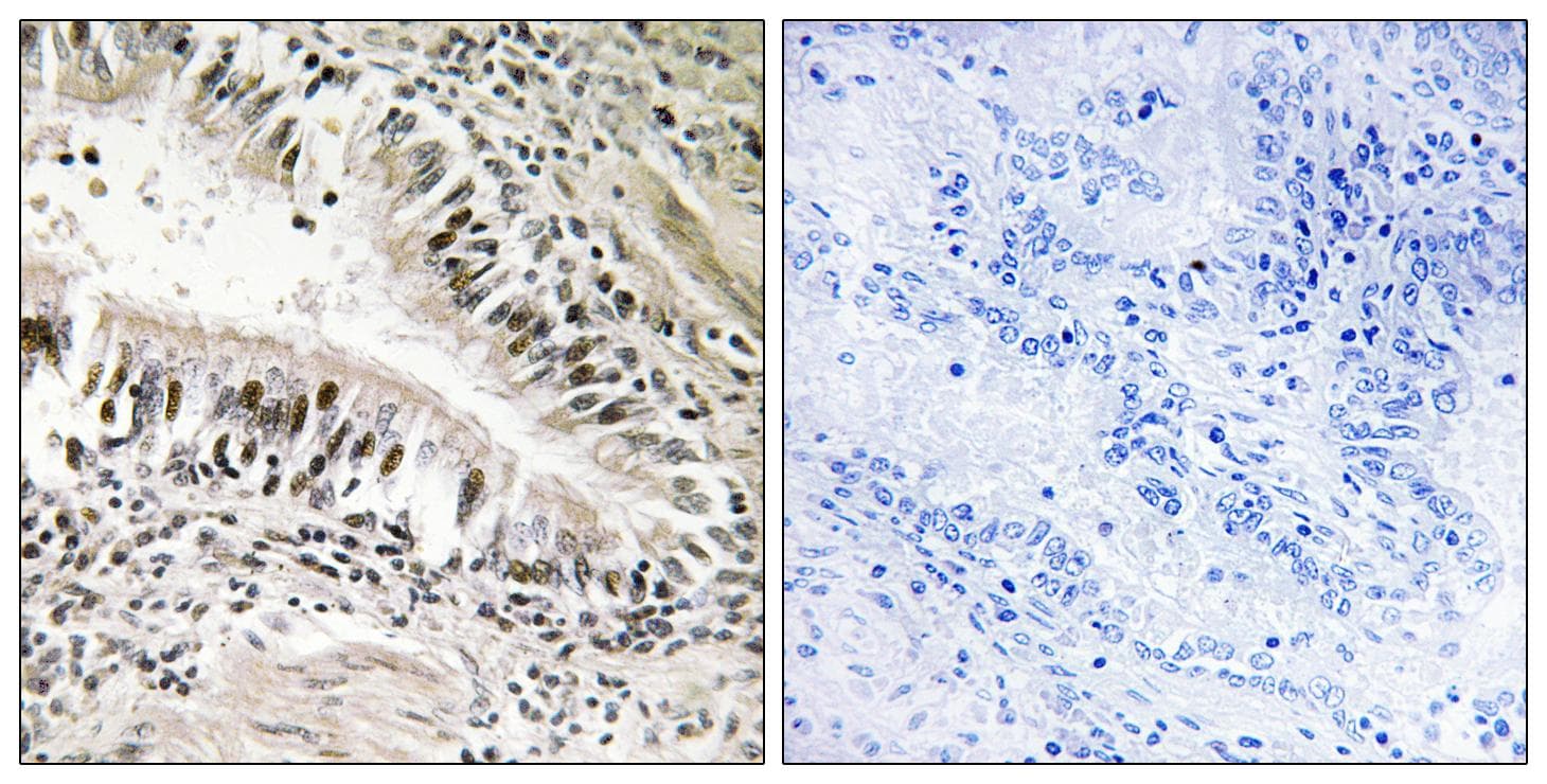STK11 / LKB1 Antibody (Ab-428)