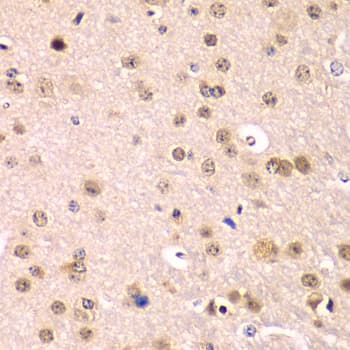 Polyclonal Rabbit anti-Human IKBKB / IKK2 / IKK Beta Antibody (IHC, IF, WB)