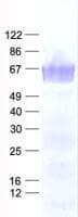 Human PRELID2 Protein (Recombinant His, N-Terminal)