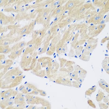 TGM5 / Transglutaminase 5 Antibody