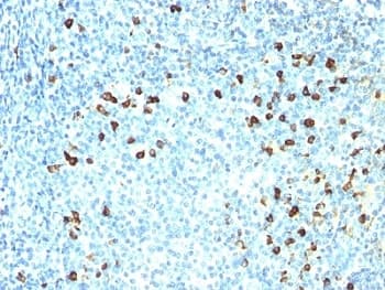 Mouse Anti-Human Kappa Light Chain Secondary Antibody (clone SPM558)