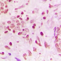 ZNF608 Antibody (C-Terminus)