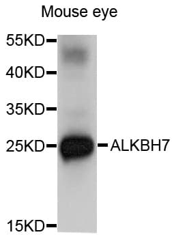 Polyclonal Rabbit anti-Human ALKBH7 Antibody (WB)