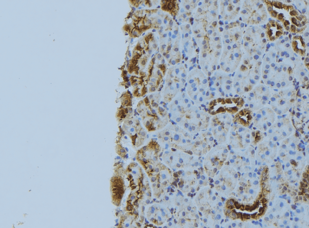 NBR1 Antibody