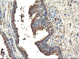 TUBAL3 Antibody (clone OTI4D8)