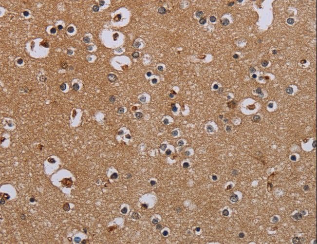 IFRD1 / TIS7 Antibody
