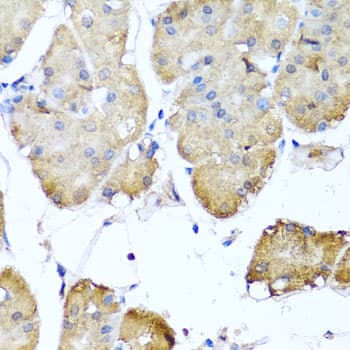 NIN / Ninein Antibody