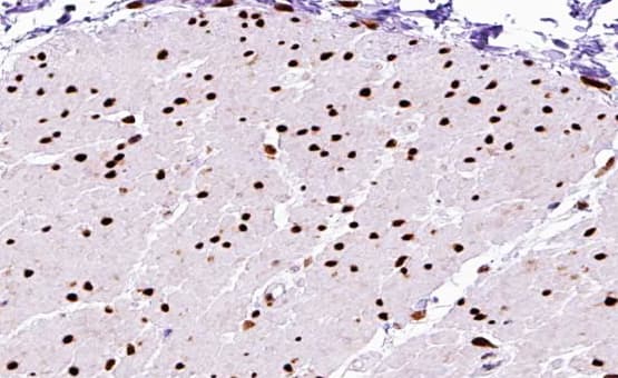 MEF2A / MEF2 Antibody (phospho-Thr312)