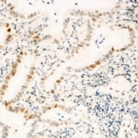 ZNF596 Antibody (Internal)