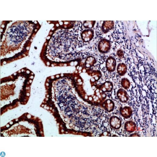 Polyclonal Rabbit anti-Human IL37 Antibody (IHC)